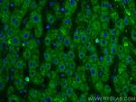 Factor X Antibody in Immunohistochemistry (PFA fixed) (IHC (PFA))