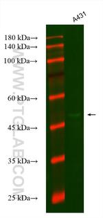 SLC25A1 Antibody in Western Blot (WB)