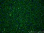SSTR5 Antibody in Immunohistochemistry (PFA fixed) (IHC (PFA))