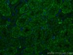SSTR5 Antibody in Immunohistochemistry (PFA fixed) (IHC (PFA))
