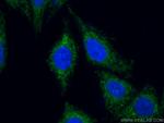 MFN1 Antibody in Immunocytochemistry (ICC/IF)