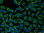 FNTB Antibody in Immunocytochemistry (ICC/IF)
