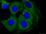 PTPN11 Antibody in Immunocytochemistry (ICC/IF)