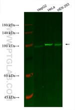 Cytokeratin 16 Antibody in Western Blot (WB)