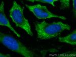PCK1 Antibody in Immunocytochemistry (ICC/IF)