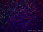 CD8 Antibody in Immunohistochemistry (PFA fixed) (IHC (PFA))