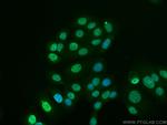 KPNA2 Antibody in Immunocytochemistry (ICC/IF)