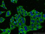 UPF1 Antibody in Immunocytochemistry (ICC/IF)