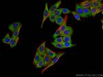 PPARG Antibody in Immunocytochemistry (ICC/IF)
