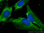 LXN Antibody in Immunocytochemistry (ICC/IF)