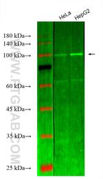 Hexokinase 2 Antibody in Western Blot (WB)