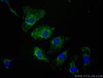 EPO Antibody in Immunocytochemistry (ICC/IF)