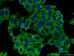 CAPN2 Antibody in Immunocytochemistry (ICC/IF)