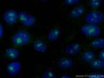 FBL Antibody in Immunocytochemistry (ICC/IF)