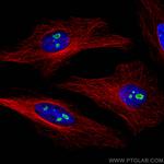 FBL Antibody in Immunocytochemistry (ICC/IF)