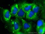 Neuroserpin Antibody in Immunocytochemistry (ICC/IF)