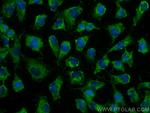 NEU1 Antibody in Immunocytochemistry (ICC/IF)