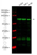 ADRBK1 Antibody in Western Blot (WB)