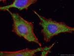 ATG9A Antibody in Immunocytochemistry (ICC/IF)