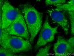 VEGFC Antibody in Immunocytochemistry (ICC/IF)