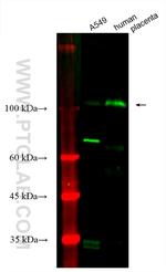 LOXL2 Antibody in Western Blot (WB)