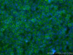 RIAM, APBB1IP Antibody in Immunocytochemistry (ICC/IF)