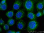 RASEF Antibody in Immunocytochemistry (ICC/IF)