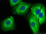 ACLY Antibody in Immunocytochemistry (ICC/IF)