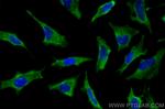 CUL2 Antibody in Immunocytochemistry (ICC/IF)