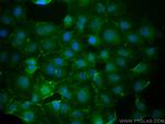 MRP1 Antibody in Immunocytochemistry (ICC/IF)