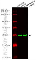 TPM4 Antibody in Western Blot (WB)