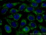 GNMT Antibody in Immunocytochemistry (ICC/IF)