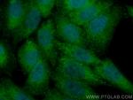 MAP2K4 Antibody in Immunocytochemistry (ICC/IF)
