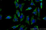 UGDH Antibody in Immunocytochemistry (ICC/IF)