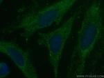 Caspase 4 Antibody in Immunocytochemistry (ICC/IF)