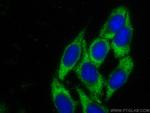 CCT5 Antibody in Immunocytochemistry (ICC/IF)