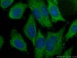 AMPD2 Antibody in Immunocytochemistry (ICC/IF)