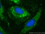 CYP20A1 Antibody in Immunocytochemistry (ICC/IF)