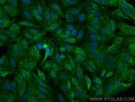 MTH1 Antibody in Immunocytochemistry (ICC/IF)