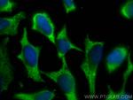 PSMG3 Antibody in Immunocytochemistry (ICC/IF)