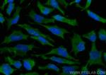 UBC12 Antibody in Immunocytochemistry (ICC/IF)