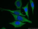 EEF1A1 Antibody in Immunocytochemistry (ICC/IF)
