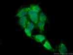 RB1 Antibody in Immunocytochemistry (ICC/IF)