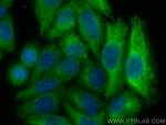 GSDMB Antibody in Immunocytochemistry (ICC/IF)