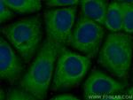 CCT8 Antibody in Immunocytochemistry (ICC/IF)