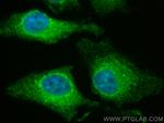 Calumenin Antibody in Immunocytochemistry (ICC/IF)