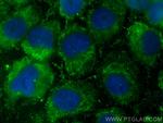 NOXA2/p67phox Antibody in Immunocytochemistry (ICC/IF)