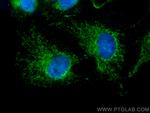 PRX5 Antibody in Immunocytochemistry (ICC/IF)
