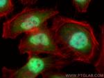 PI3 Kinase p85 Beta Antibody in Immunocytochemistry (ICC/IF)