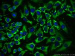 PROCR Antibody in Immunocytochemistry (ICC/IF)
